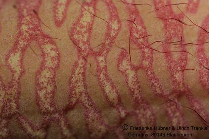 Orbea caudata ssp rhodesiaca x Stapelia sp (FH05,071) 008 – Asclepidarium